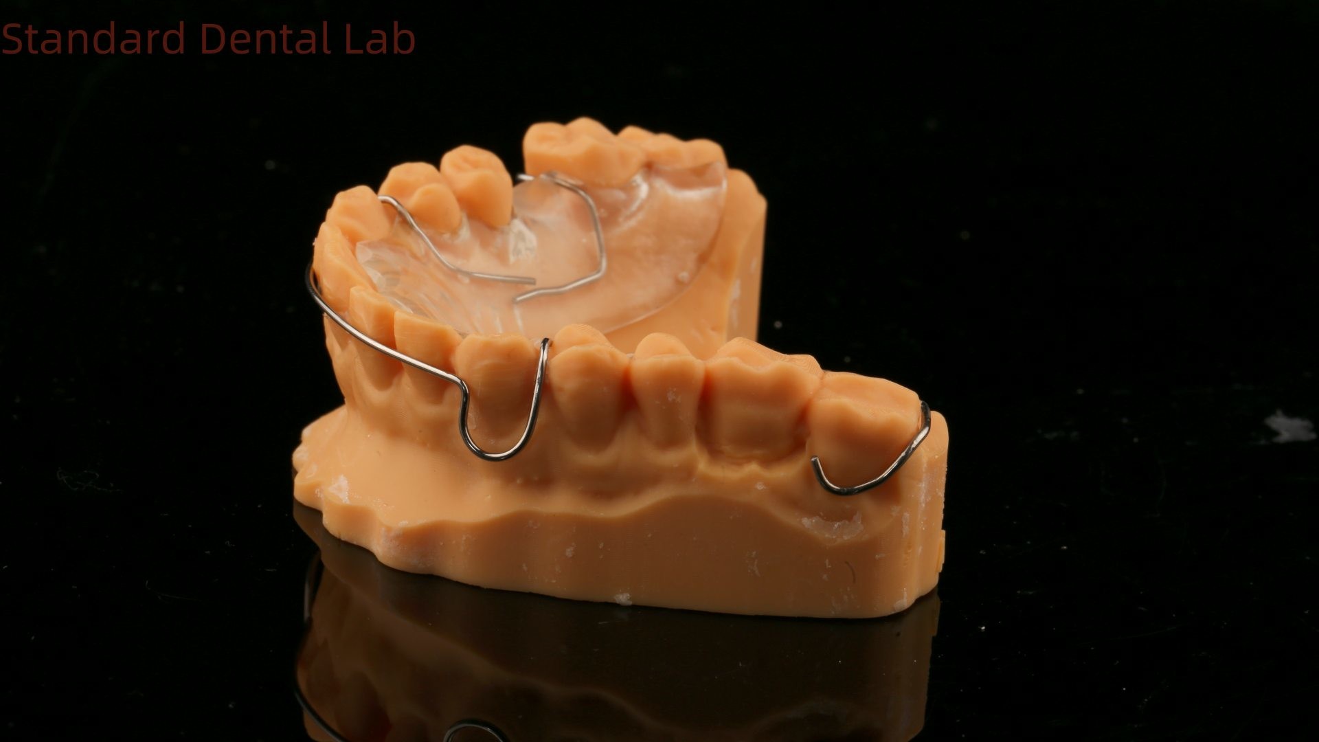 Perfect Fit Germany Ortho Teeth Halley Retainer for Esthetics and Adjustability Clear Shade SDL Dental Lab