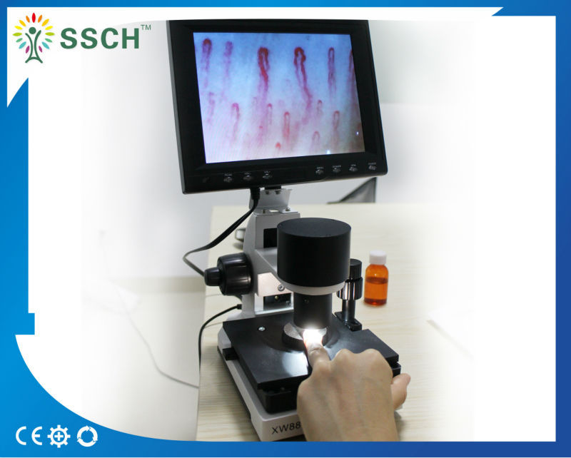 CE Approved LCD Screen Medical Microscope Capillary Microcirculation