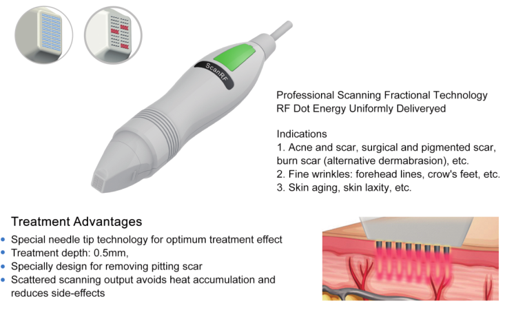 RF 1MHz Acne Treatment Machine 15 Inch Display Scar Treatment