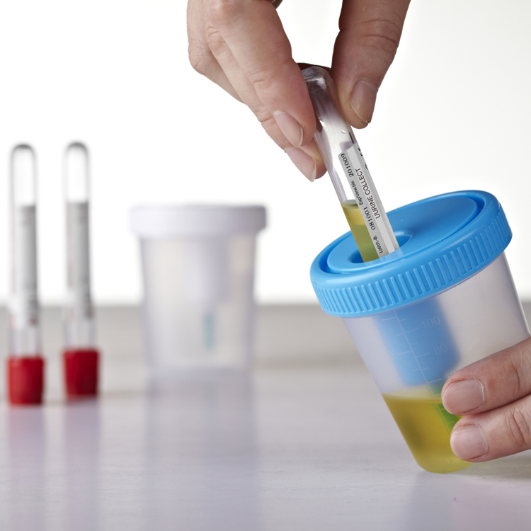 Medical Labs Disposable Plastic Urine Container with Needle