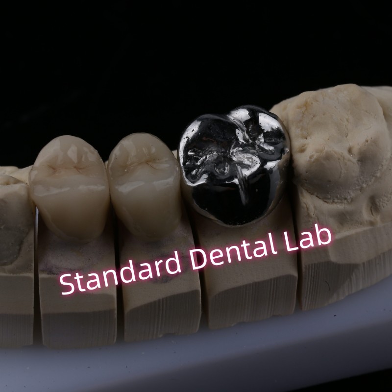 Metal Cast Post Core Crown Cocr Accurate Retentive Full Zirconia Bruxier