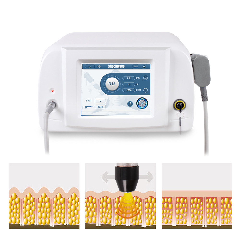 Pain Relief Shockwave Therapy Machine For Erectile Dysfunction (ED) Treatment