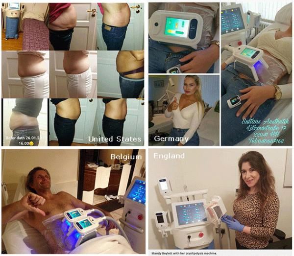 Body Weight Loss Sculpting Slimming Freeze Fat 4 handles cryolipolysis body