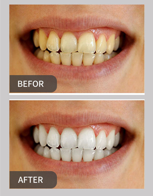 OEM Teeth Whitening Powder ECO Vegan Charcoal Powder Toothpaste