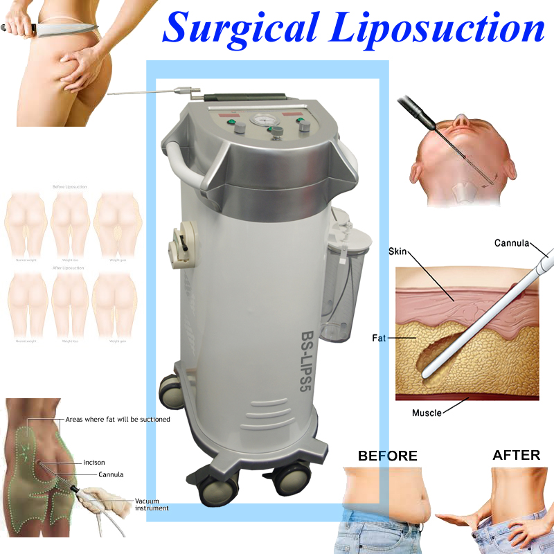 BS-LIPS5 PAL Liposuction fat reduce PAL body slimming surgical liposuction