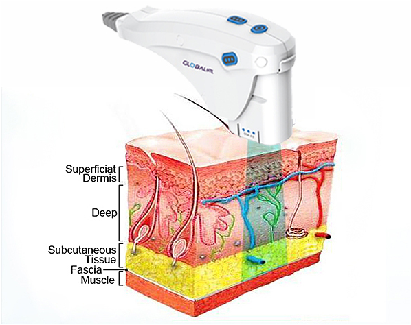 3.2Mhz Frequency HIFU Machine For Skin Rejuvenation Facial Treatment 45 * 31.5 * 39.5cm