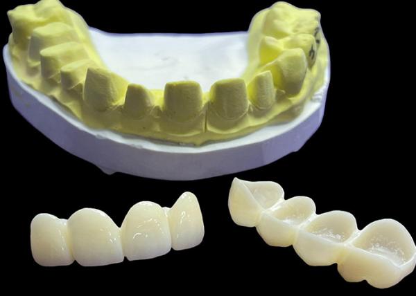 Stain Resistant Dental Porcelain Crowns and Bridges in Vita Classical Shades for