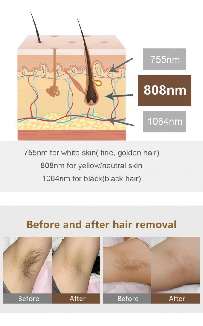 Safety Hair Removal Laser Machine , Permanent Hair Removal Machine For Female