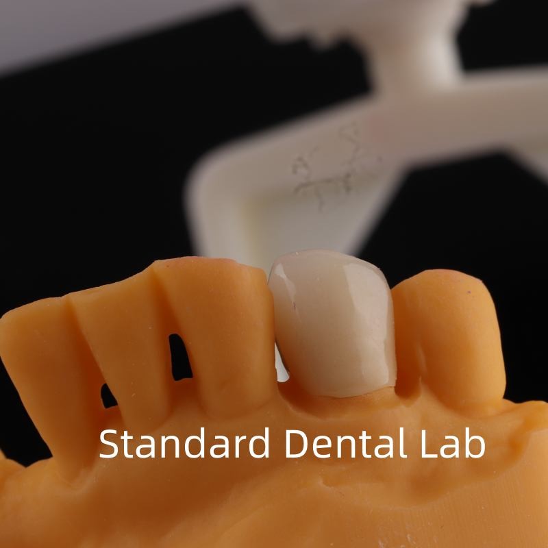 Full Contour Dental Lab Crowns High Translucency Solid Zirconia Crown China Dental Lab