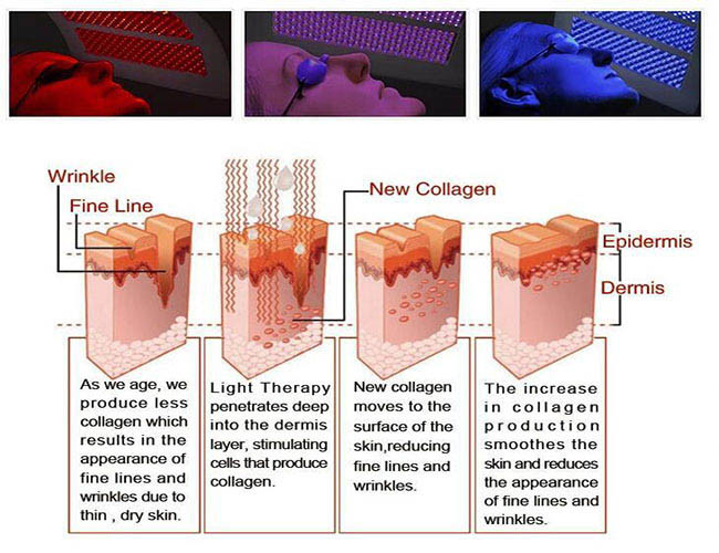 Oxygen Jet Peel Diamond Skin Rejuvenation PDT Skin Care Machine