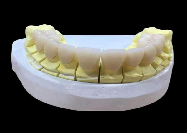 Zirconia porcelain Dental Crown with Aesthetic and Natural-Looking Finish from