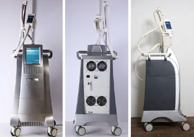 cryolipolysis fat removal