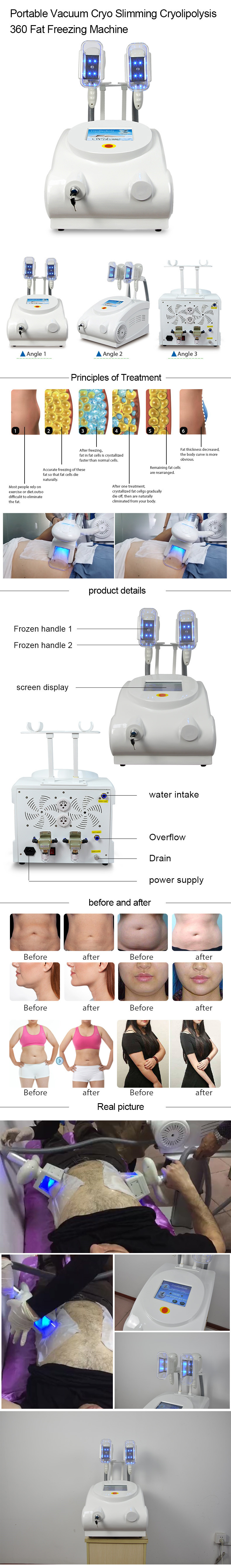 Weight Loss Cryolipolysis Slimming Machine 110V 5Mhz Cellulite Removal