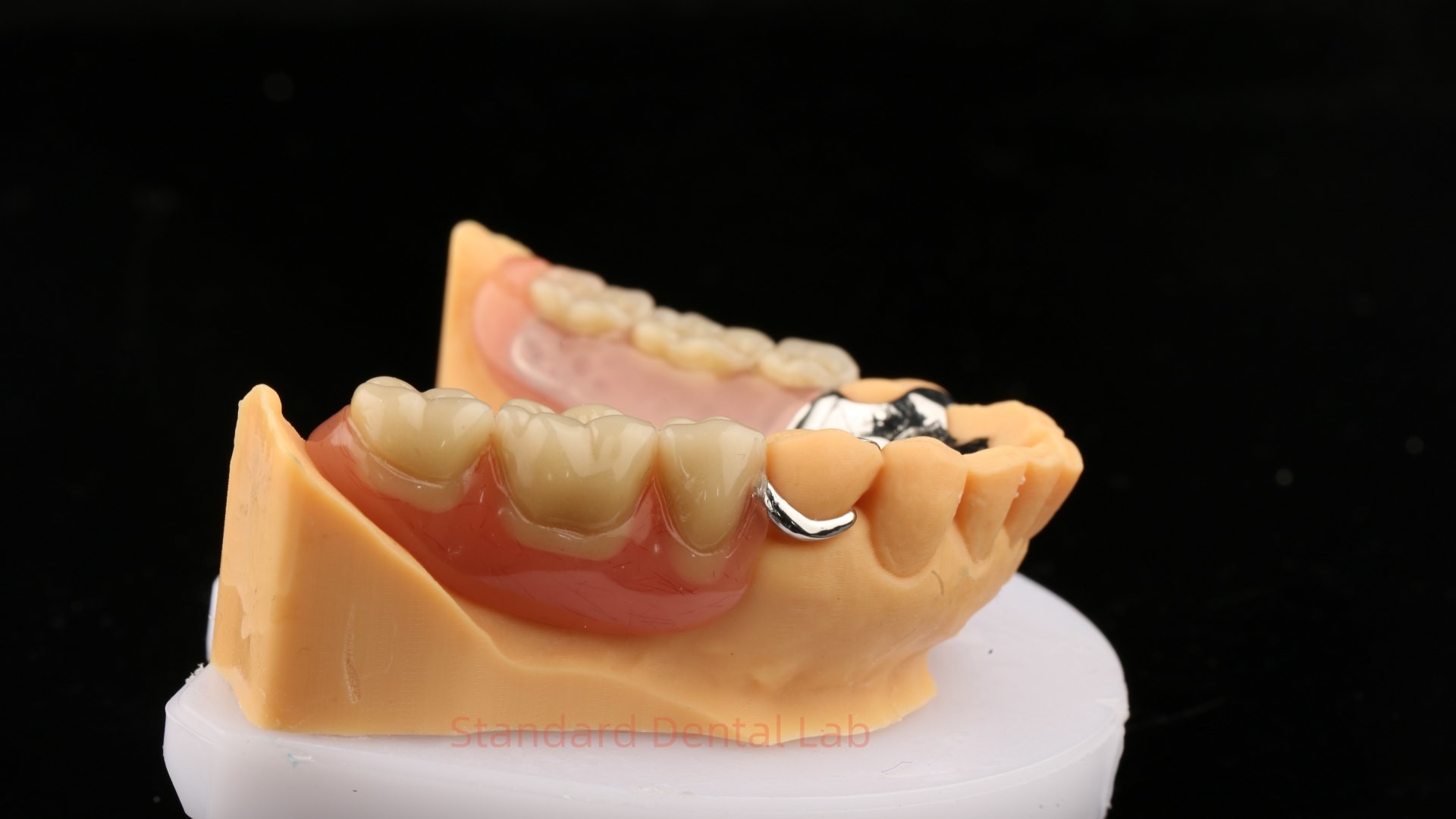 Metal Alloys Cobalt Chromium Partial Denture Ivoclar Scheftner Comfortable Cast Metal Framewrok