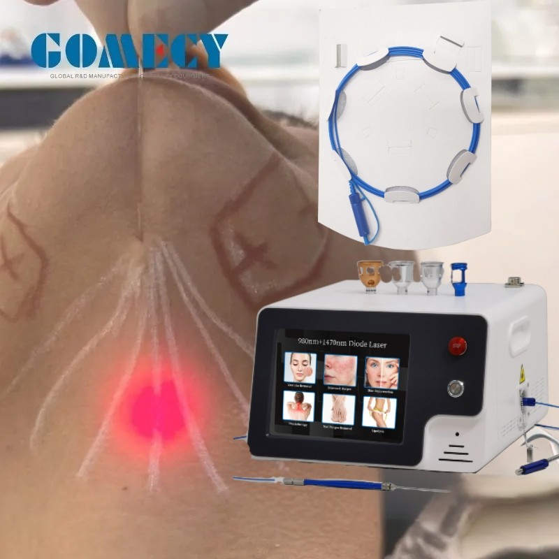 980nm 1470nm Endolaser Face Lift Lipolysis Machine Diode Laser Fat Removal Endolifting Lipolysis Laser Liposuction Equipment