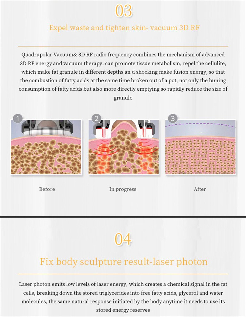 6 In 1 Radio Frequency 40k Ultrasonic Cavitation Machine Skin Tightening Fat Loss