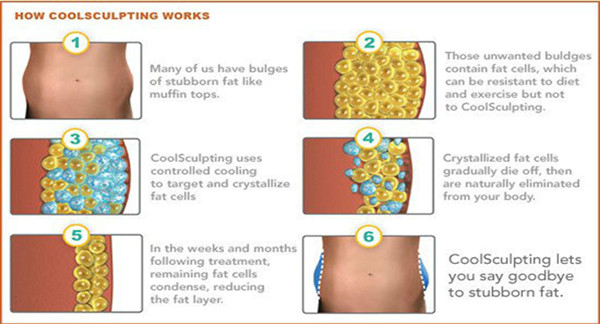 CE approved 3 years warranty cryolipolysis fat burning machine