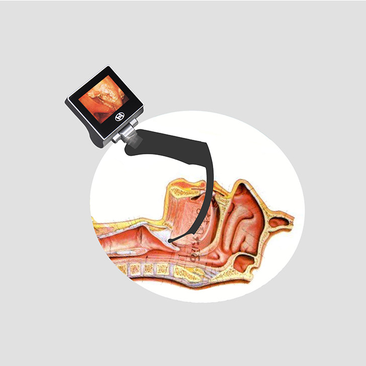 Removable Intubation Laryngeal Mirror Laryngoscope Set Portable Display