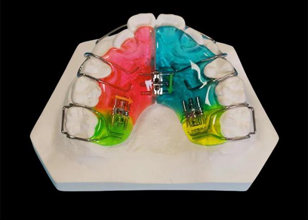 Clinically Proven Dental Removable Appliance , Comfortable Fit Orthodontic