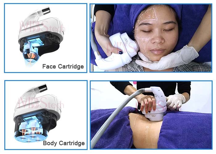 Cooling Skin Water Cooling 5D ICE HIFU Face Lifting Machine