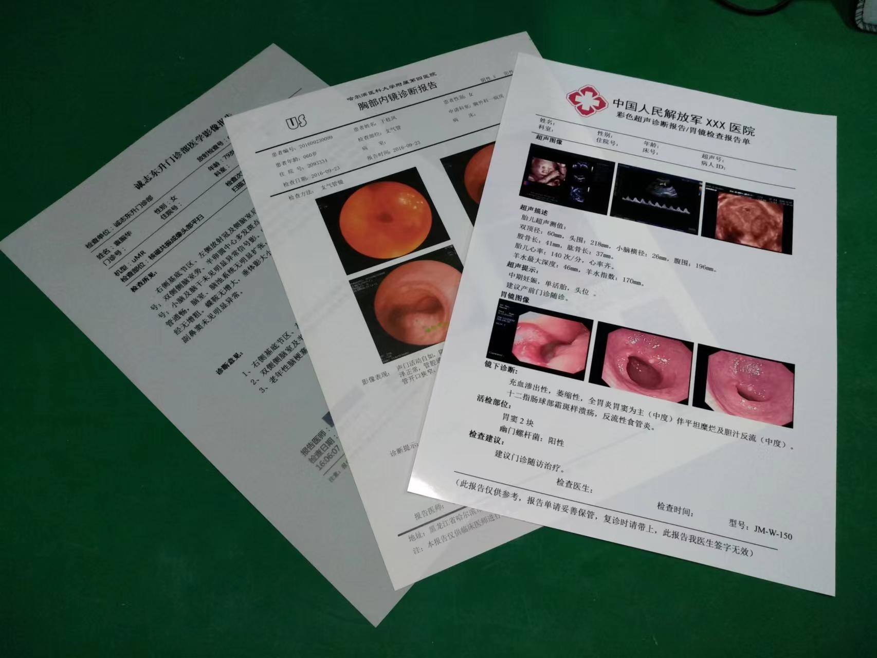 204±8 μM Thickness Medical Dry Film With High Durability ≤20% Haze UV Resistance