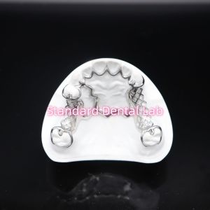 Printed Scheftner Metal Partial Denture Framework Accurate Customized Cast