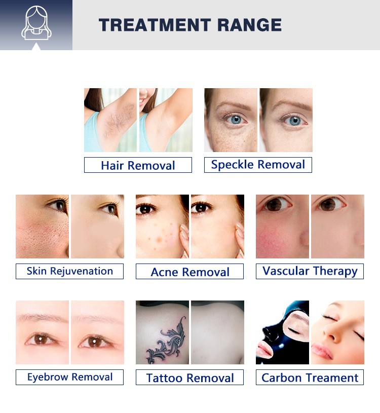AS20 Professional Nd Yag OPT Beauty Machine Laser for salon OEM Pigment hair tattoo Removal device women carbon peeling