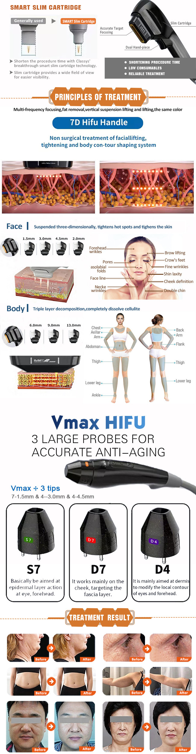 Ultra 7d DS4-4.5 Hifu Body Slimming Machine 5mm Portable Lipo Cavitation
