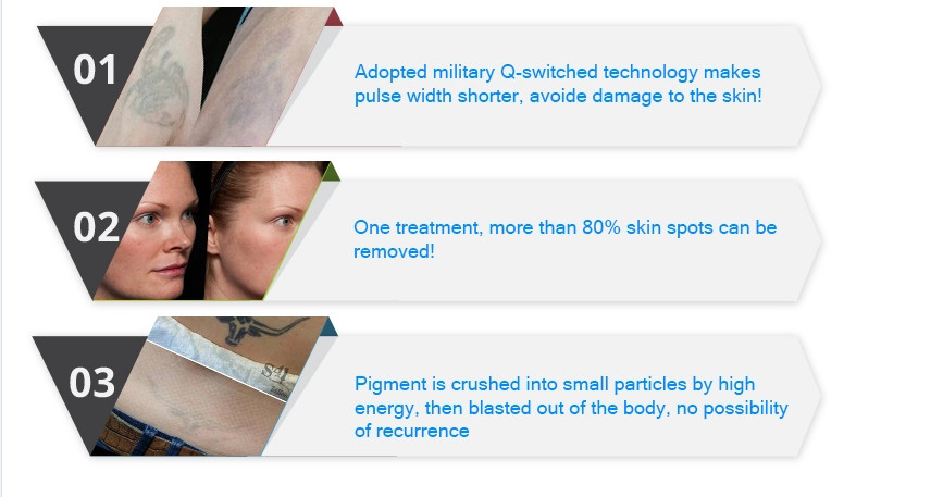 The Best Advanced Big Power Korean 755 532 1064nm Pigmenation Removal Picosecond Laser FDA CE FDA CE