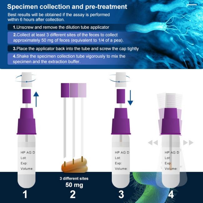 One Step H Pylori Antigen Test Kit 99% Accuracy Helicobacter Infectious Disease Test