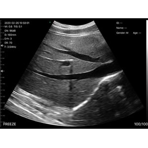 USB Convex Ultrasound Transducer Wireless Convex Array Ultrasound Probe for OB