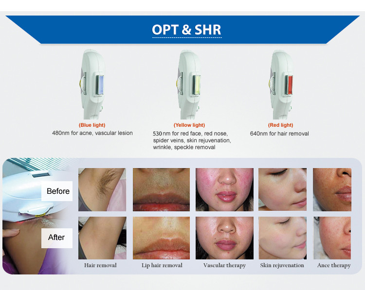 Opt Nd Yag Rf Laser Beauty Machine Distributor Dual Screen 3 In 1