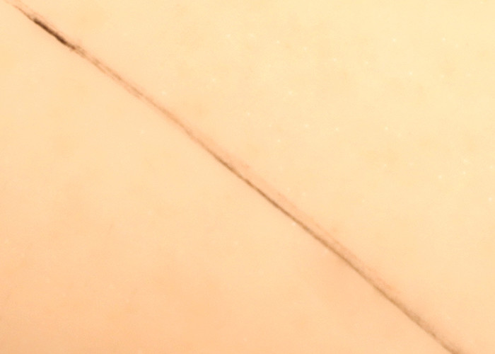 Face Deep Pre - Ink Mapping Line Mark Ruler Microblading With Ink Pigments