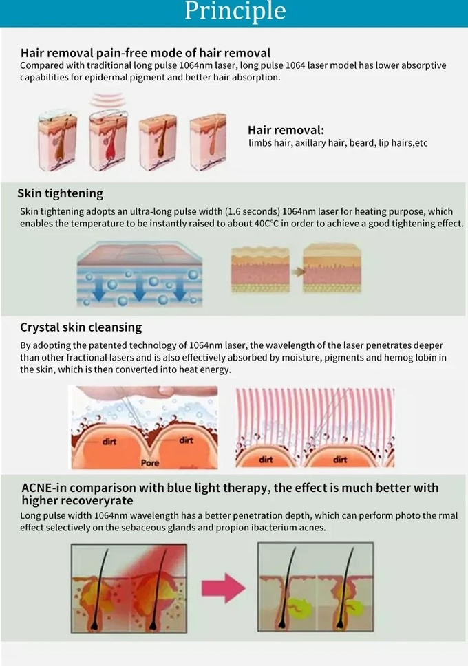 Painless 1064nm Nd Yag Laser Long Pulse For Hair Removal And Skin Rejuvenation