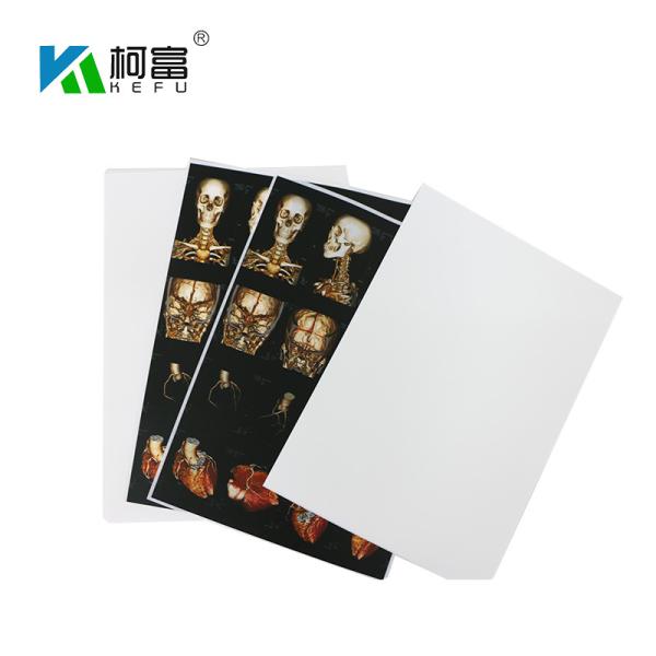 Blue White Base Medical X Ray Film 35x43CM 10x12 Inch X Ray Dry Film For Fuji