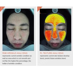 China Handheld Wireless Wifi 3d Skin Analysis Machine Digital With Video Microscope on sale