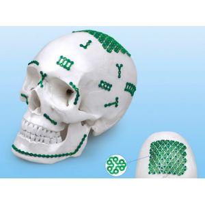 CE ISO 13485 Maxillofacial Plating System Titanium Bone Implants