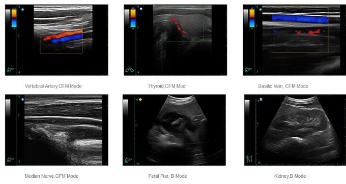 Color Doppler Ultrasound System Portable Ultrasound Scanner With 12.1 Inch LED Monitor And 2 Probe Ports