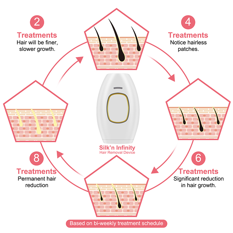Portable Ipl Hair Removal Mini Laser Hair Removal 3 In 1 Painless Permanent