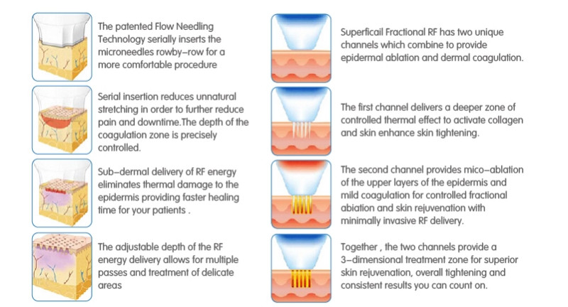 rf fractional needling therapy price micro needle machine