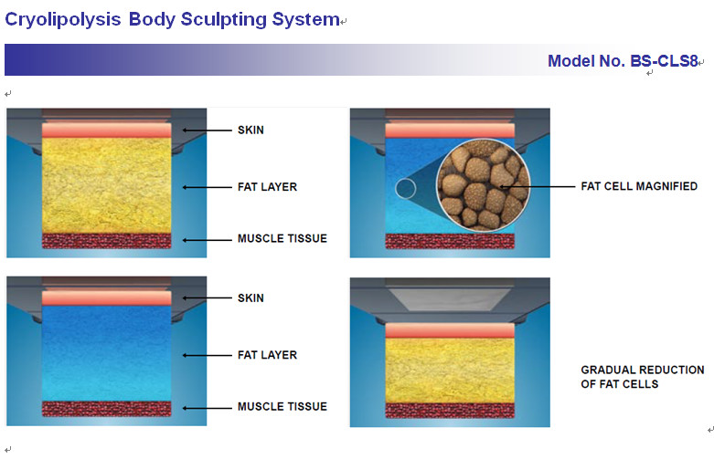 Fat Burning Cryolipolysis Fat Freeze Slimming Machine , Fat Cavitation Machine For Men Women