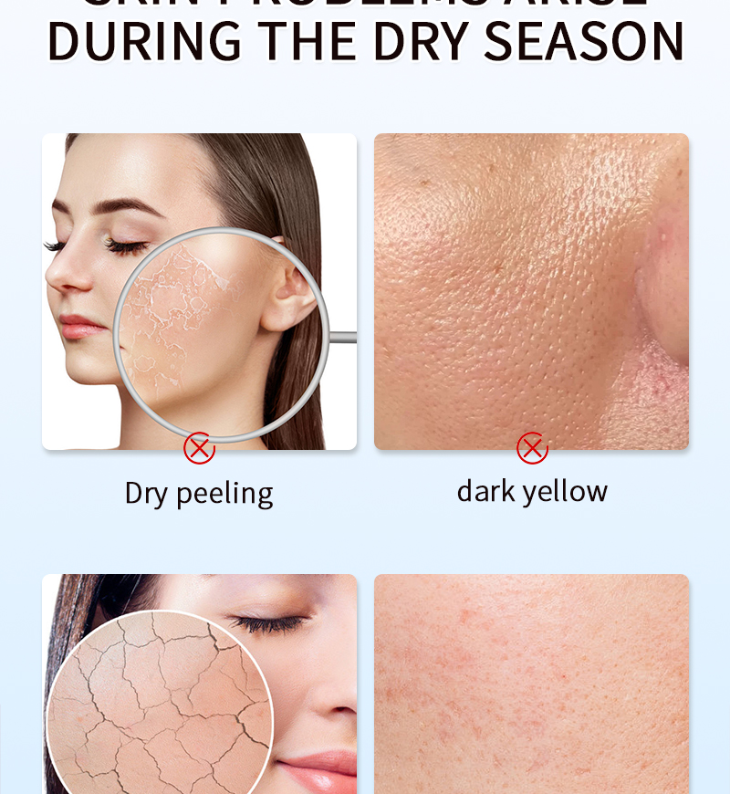 Bodycare Whitening Body Lotion Remove Black Spots And Dark Yellow Skin Care Brightening Hydrating Glutathion