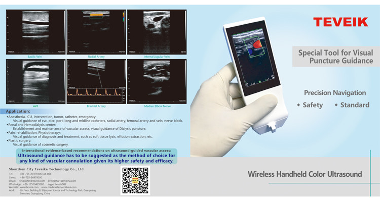 Wireless Charging Handheld Color Ultrasound Probe Transducer With Touch Display