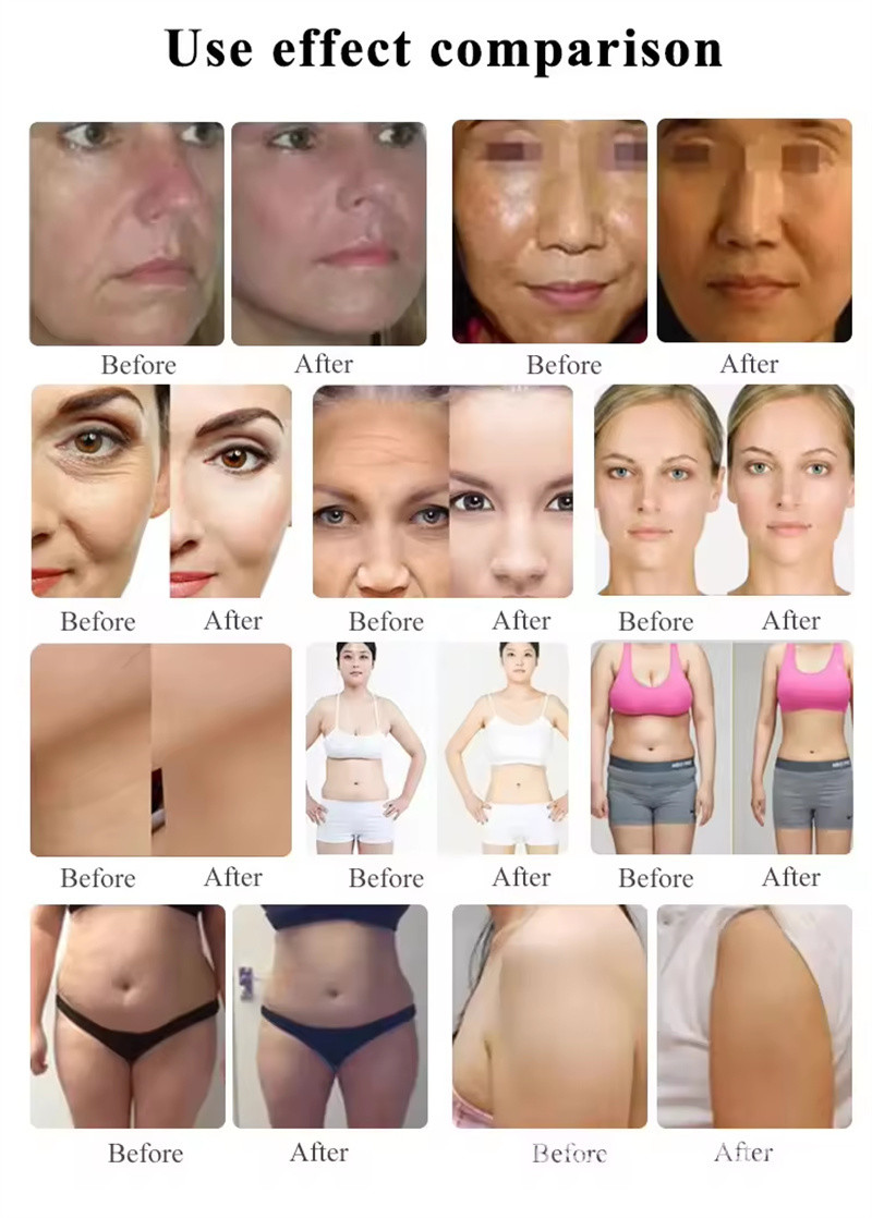 Newest Painless 9D Hifu Facial Skin Care Body Slimming Machine
