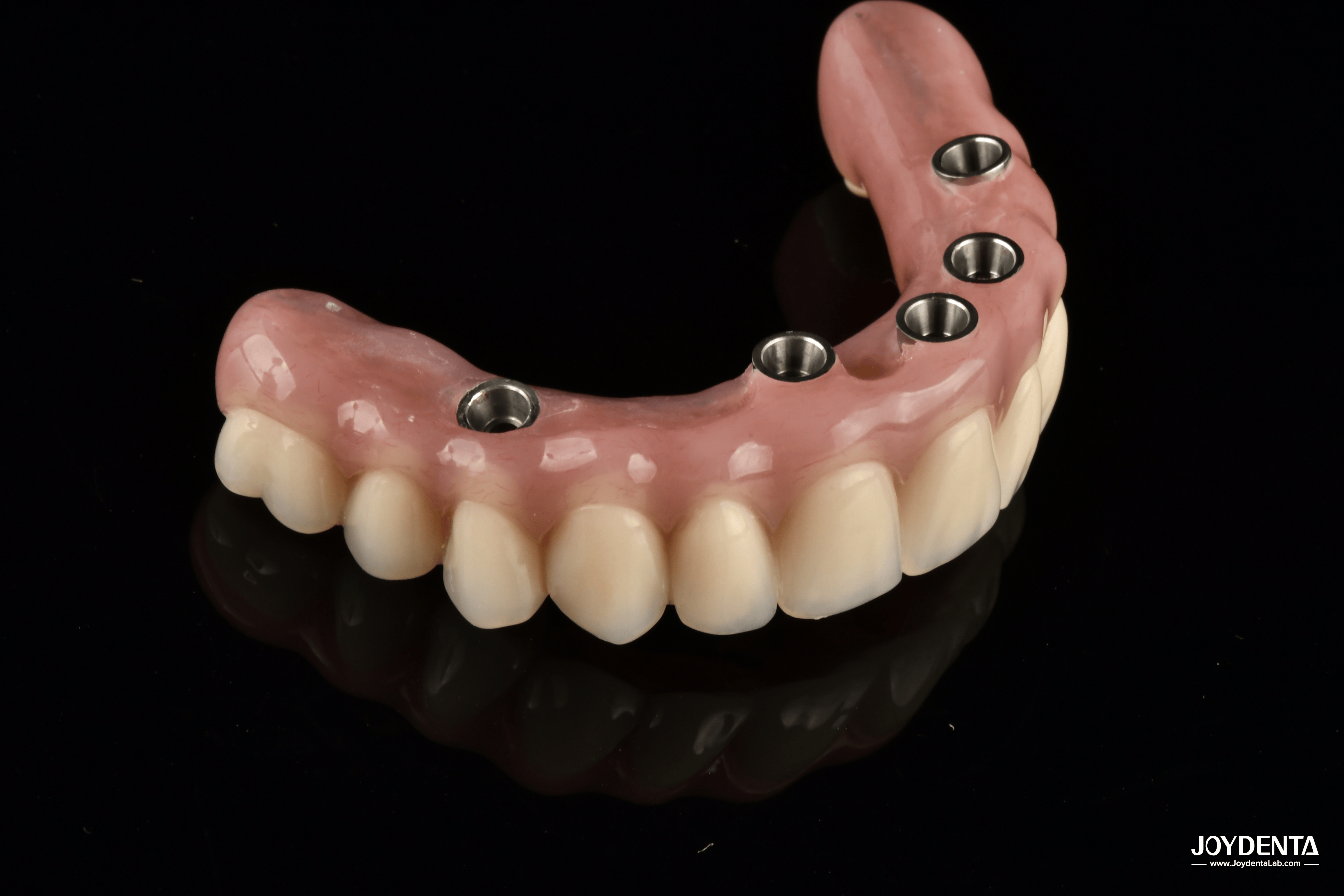 Redefining Full Arch Prosthetics: Unmatched Fit and Function with Our Ti-Base