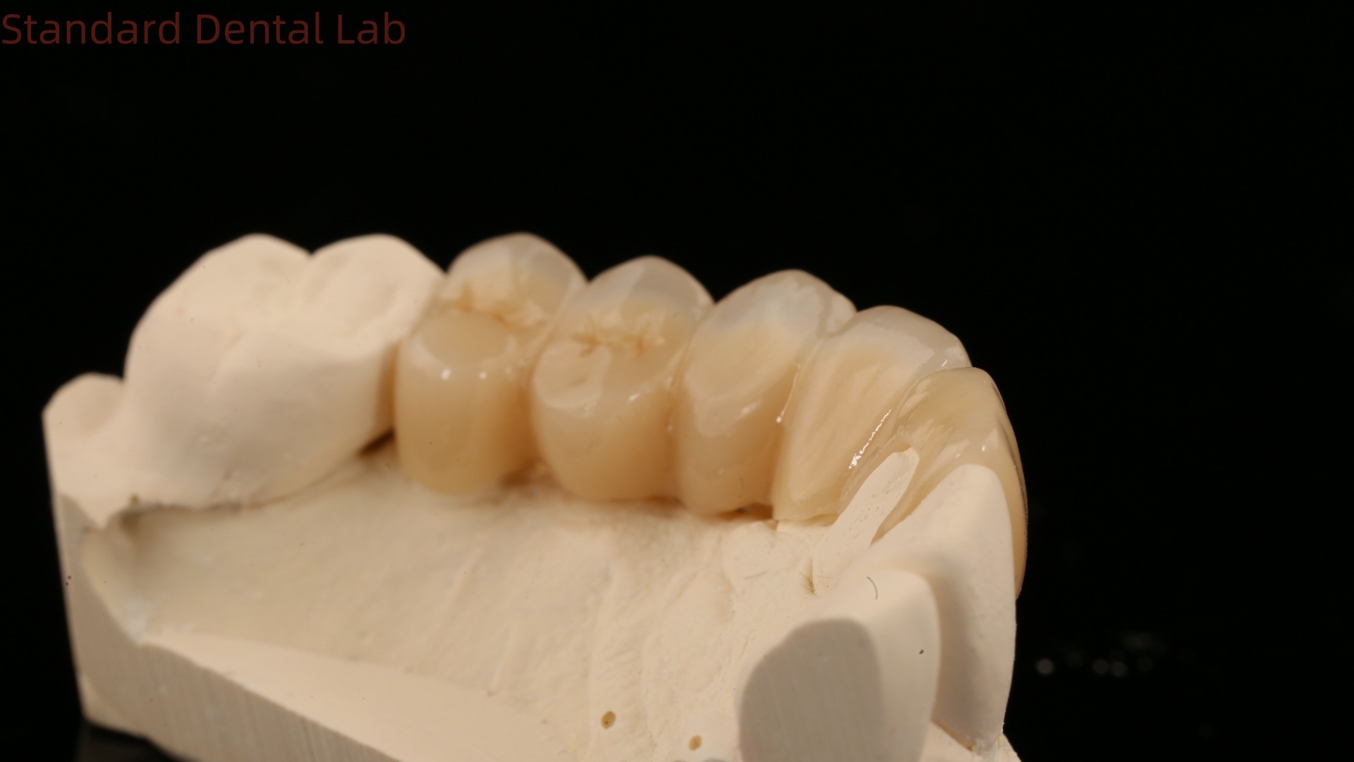 Noritake Porcelian Full Contour Zirconia Crown High Aesthetic Natural Customized Zirconia Dental Bridge