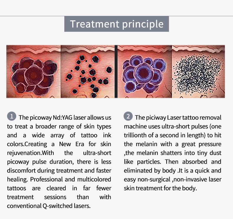 SP1multifunctional skin tightening Q Switched Laser Beauty Machine new technologies Co2 fractional laser pigment removal
