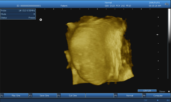 3D Digital Laptop B / W Portable Ultrasound Scanner With Convex Linear Transvaginal Probes