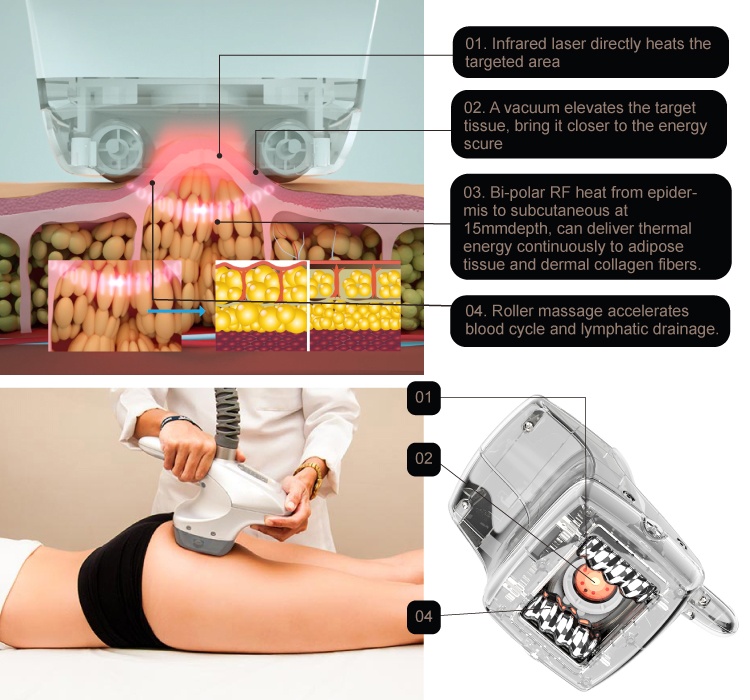 Cellulite Slimming Machine Infrared RF Body Vacuum Roller