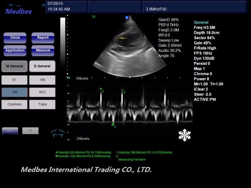 Clinic Ultrasound Scanner M-C60 Portable Color Doppler Ultrasound System